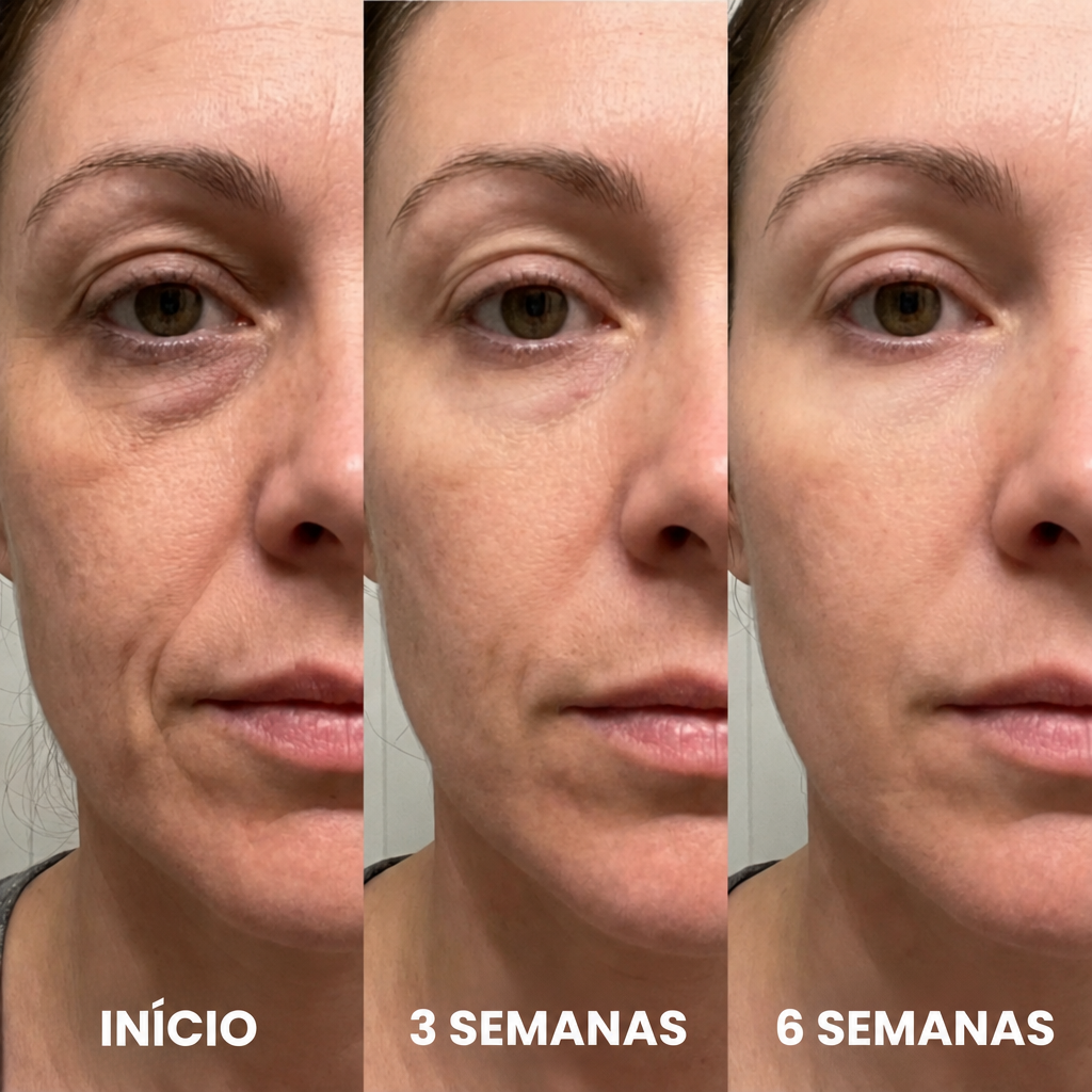 Resultados: início, 3 semanas, 6 semanas