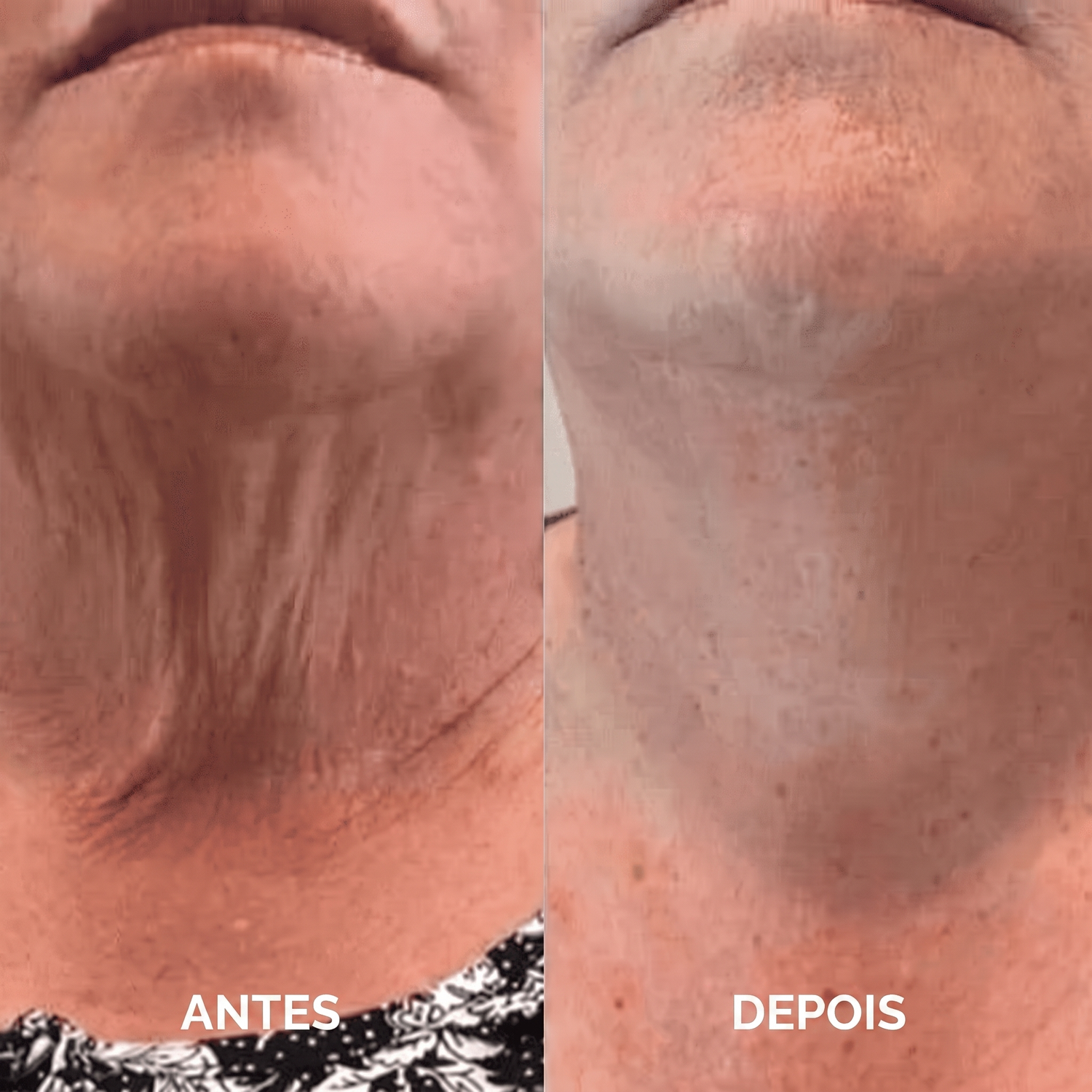 Máscara Pescoço — imagem 3